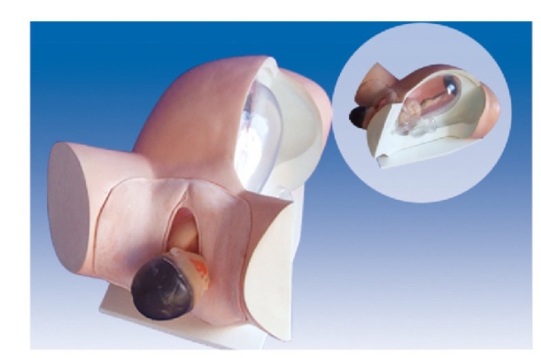 胎兒分娩機轉示教模型